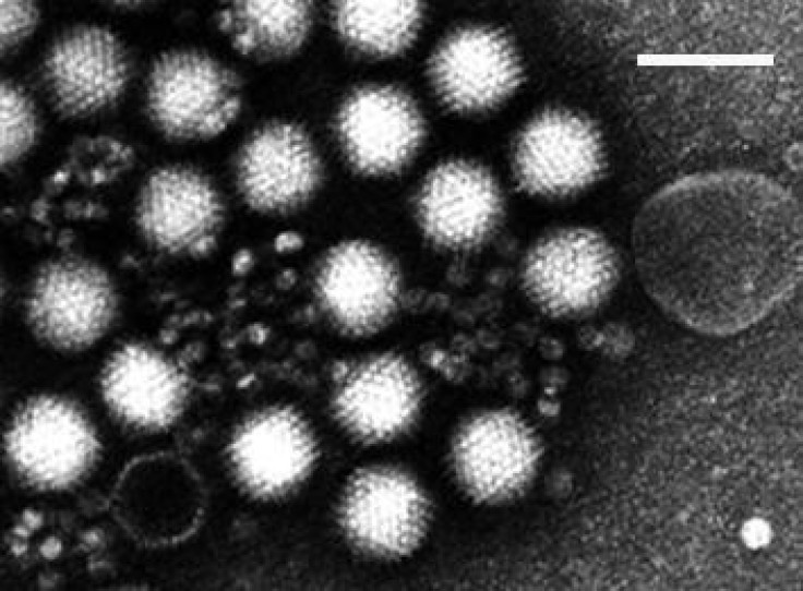 New Cold Strain Could Pose 'Serious Threat to Public Health'