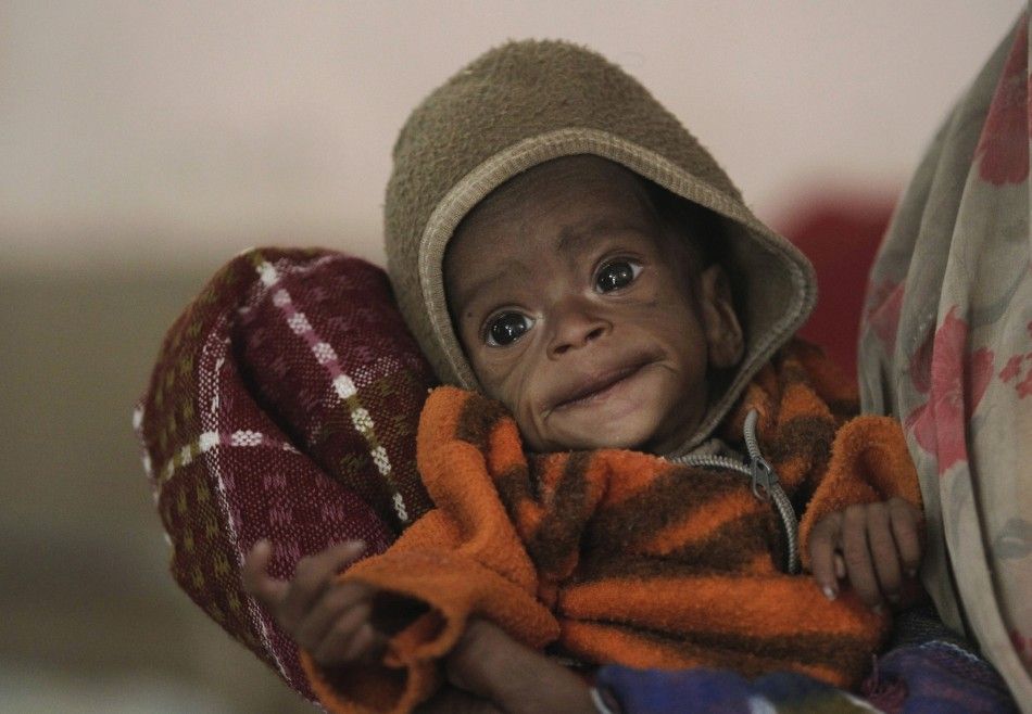 Four month-old Vishakha, who weighs less than 5 pounds, is carried into a clinic in central India