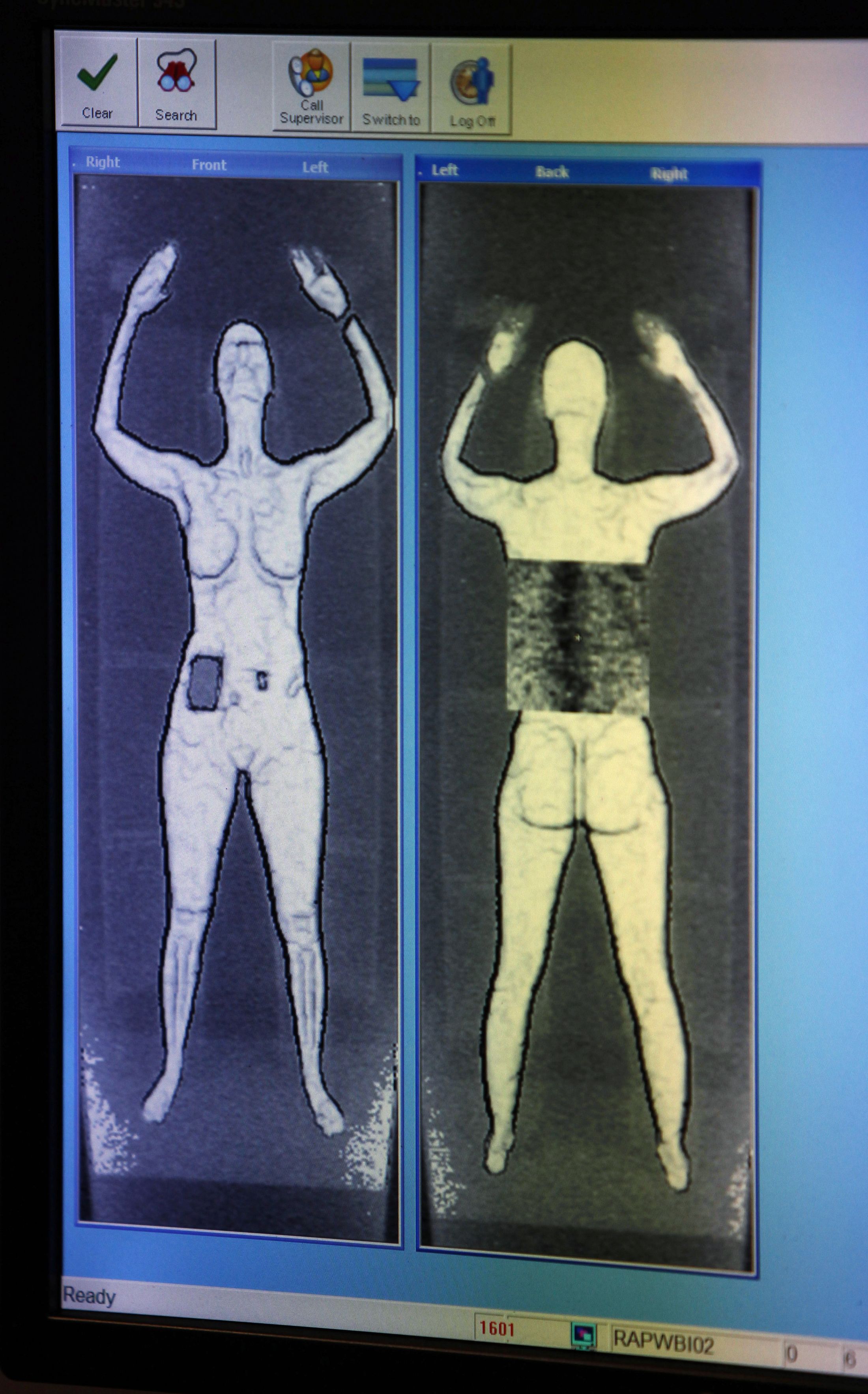 силиконовая грудь на рентгене фото 91