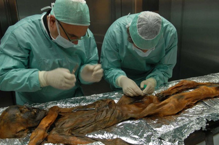 5,300-Year-Old Ice Mummy May Have Earliest Case of Lyme Disease