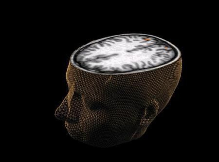 Scientists To Create Most Power Computer To Simulate Whole Human Brain