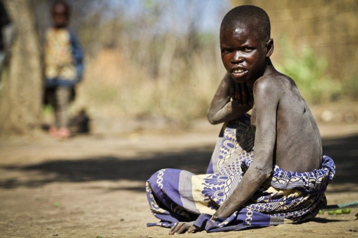 Children with nodding syndrome are prone to accidents such as drowning and burning because of mental impairment, and many of the fatalities from the disease are the result of these secondary causes.