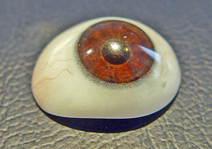 Prosthetic Eye