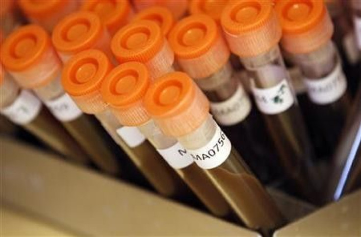 Test tubes filled with samples of bacteria to be tested are seen at the Health Protection Agency in north London March 9, 2011. Picture taken March 9, 2011. For decades scientists have managed to develop new medicines to stay at least one step ahead of th