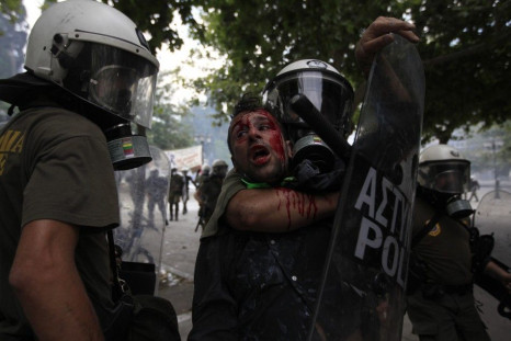A Greece protester bloodied by violent confrontation with the riot police