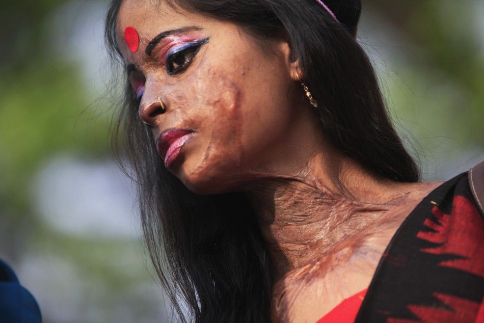  Hasina, a survivor of an acid attack, takes part in an awareness rally about the violence against women as they mark International Womens Day in Dhaka