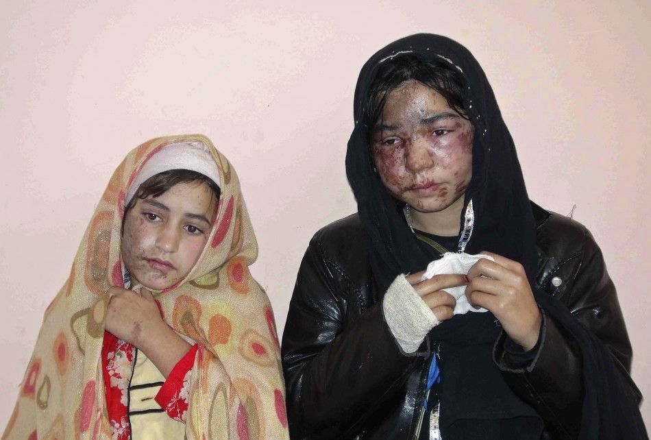Members of a family receive treatment at a hospital after being attacked with acid at their home by unknown gunmen in Kunduz