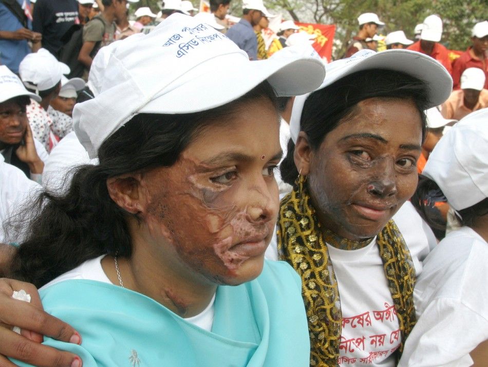  Two Bangladeshi women with faces burned by acid join a rally of thousands of men and women to mark I