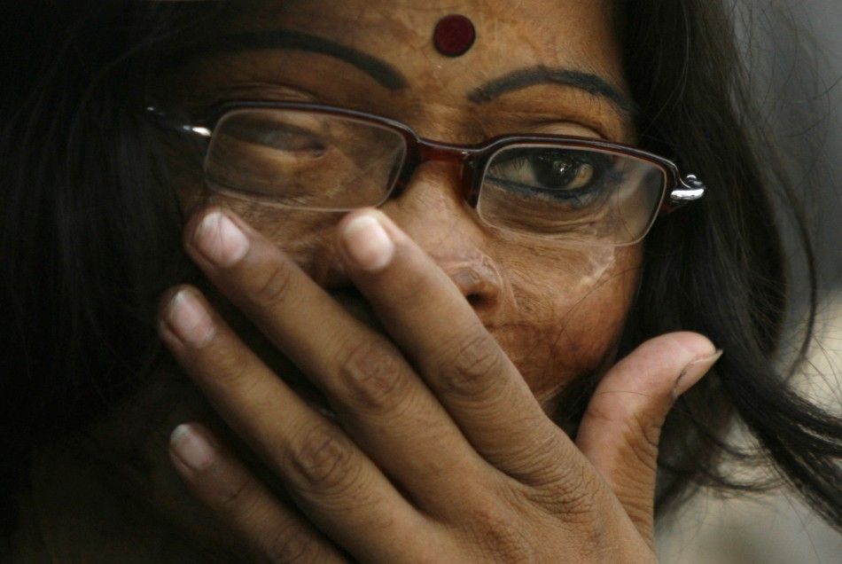 An acid attack survivor attends a conference in Dhaka