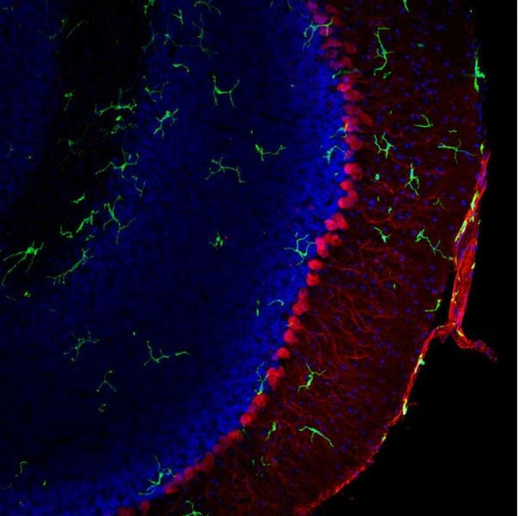 Bone Marrow Transplant Reverses Rett Syndrome in Mice