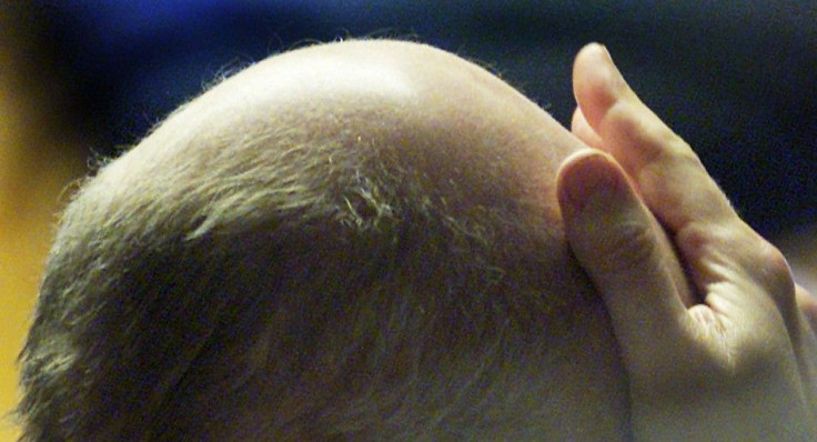 Baldness Trigger Found In Mice, May Lead To Human Treatments