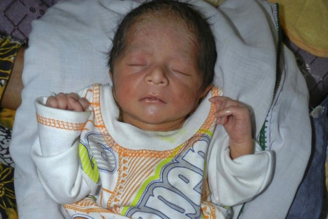 Six-Legged Baby Born Born in Pakistan