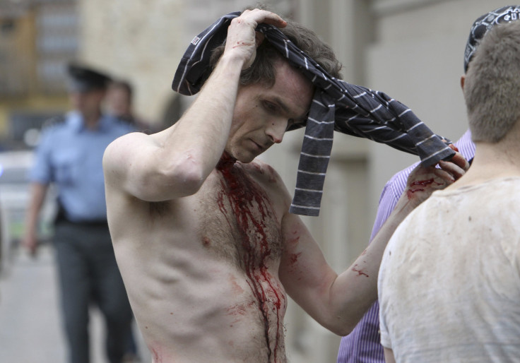 An injured man removes his shirt in Prague