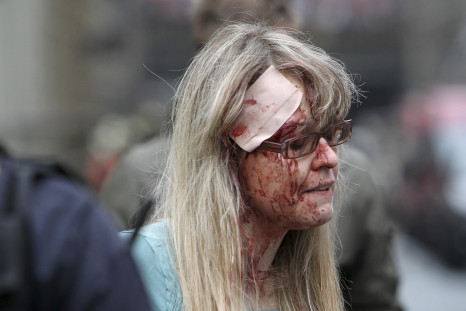 An injured woman is pictured after the explosion in Prague 