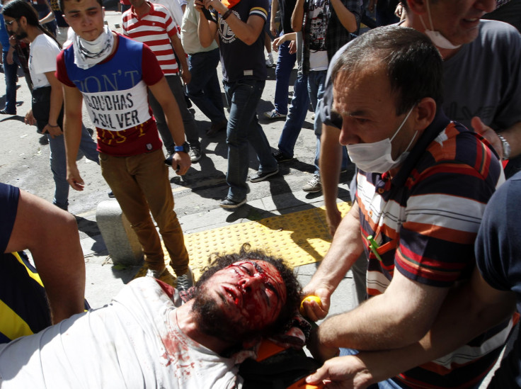 Turkey Ankara Riots 2 Injury