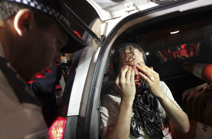 Brazil Protests Injured