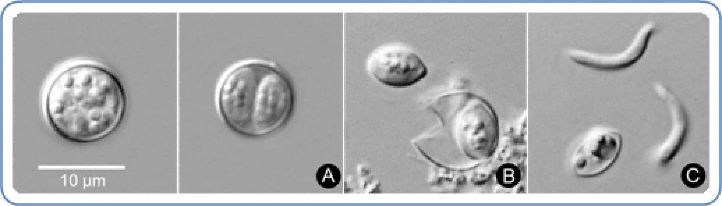 Cyclospora Outbreak: CDC Reports Over 250 People In US Infected With ...