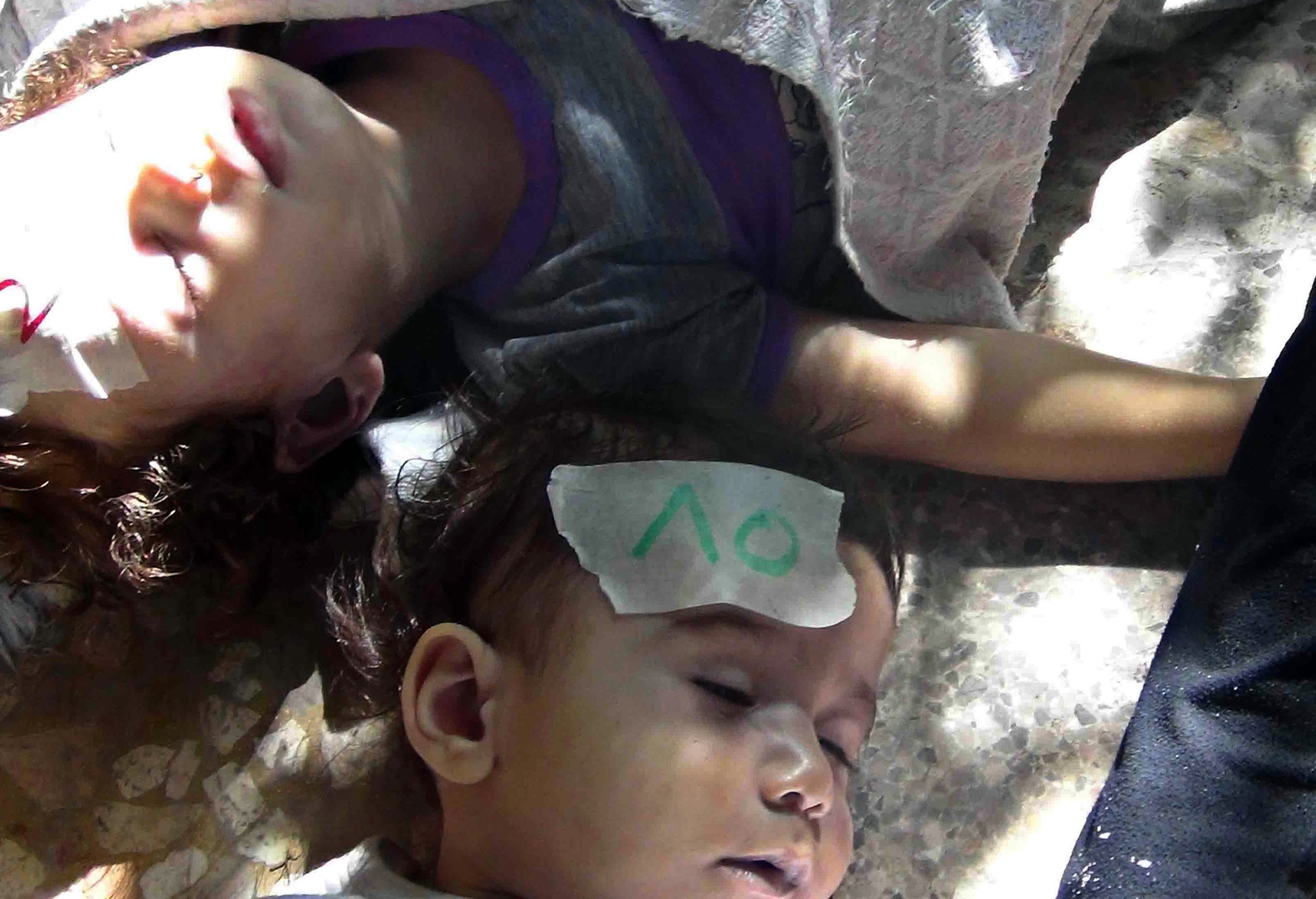 gas attack syria child casualty 2