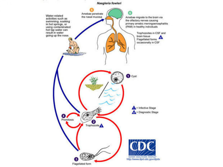Naegleria fowleri