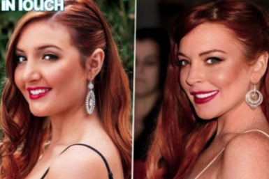 Lindsay Lohan's Step Sister Gets Plastic Surgery!