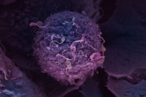 Breast-cancer-cell