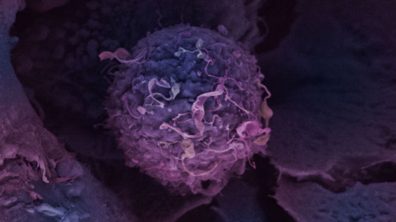Breast-cancer-cell