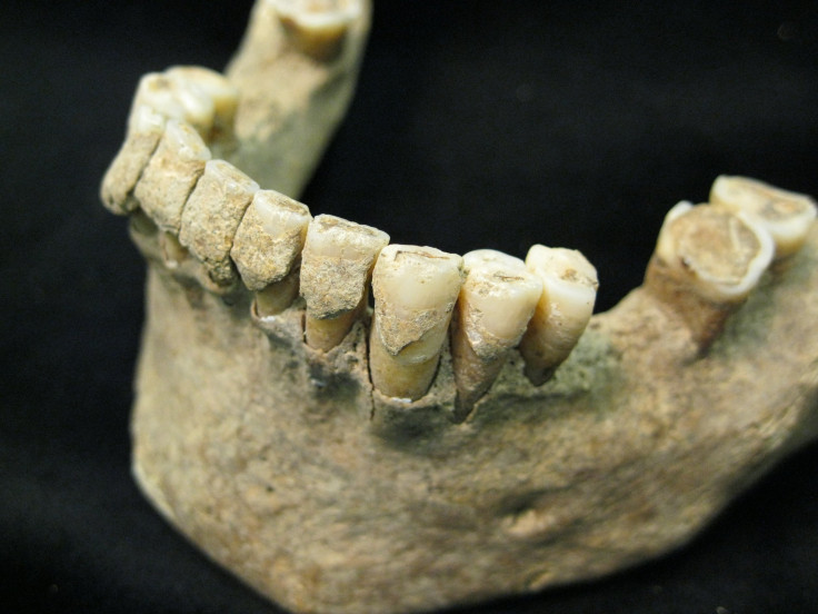 medieval-teeth