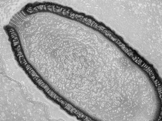 virus