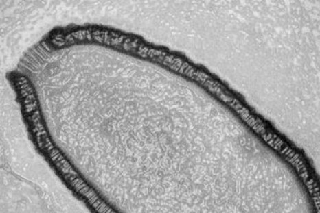 A 30,000-Year-Old Virus