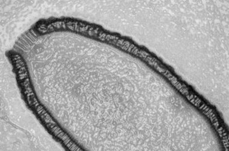 A 30,000-Year-Old Virus