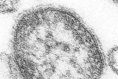 595px-Measles_virus