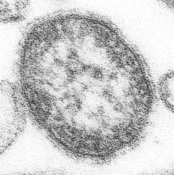 595px-Measles_virus