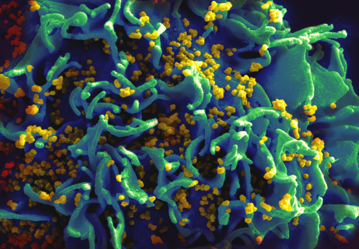 HIV_H9_T-cell_II