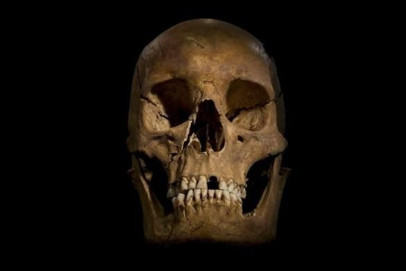 richard iii skull