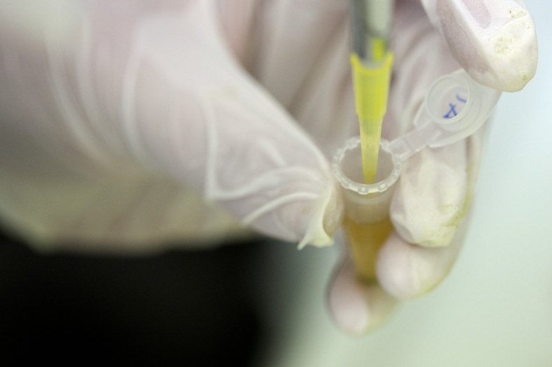 Ebola experimental treatments