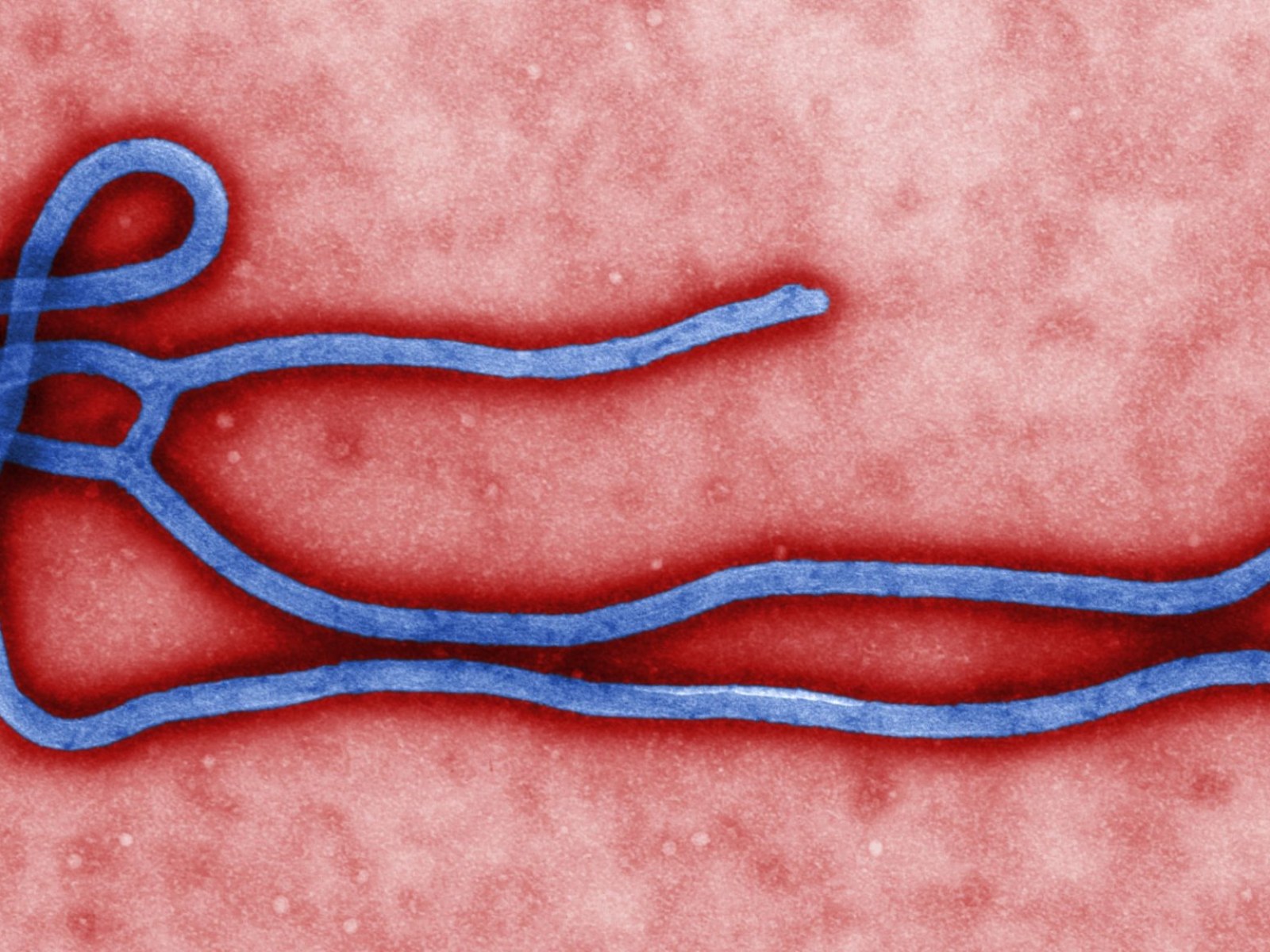 How Ebola Kills: What The Deadly Virus Does To The Human Body