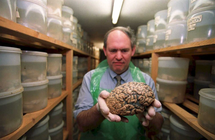 University of Texas missing brains