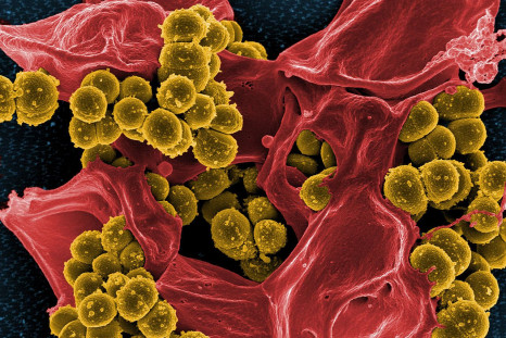 1280px-Scanning_electron_micrograph_of_Methicillin-resistant_Staphylococcus_aureus_(MRSA)_and_a_dead_Human_neutrophil_-_NIAID