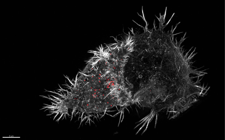 Natural killer (NK) cell immune synapse, 3D-SIM
