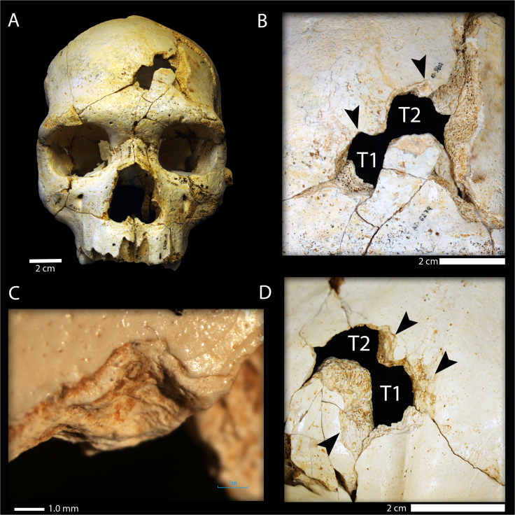 Skull-PrehistoricMurder