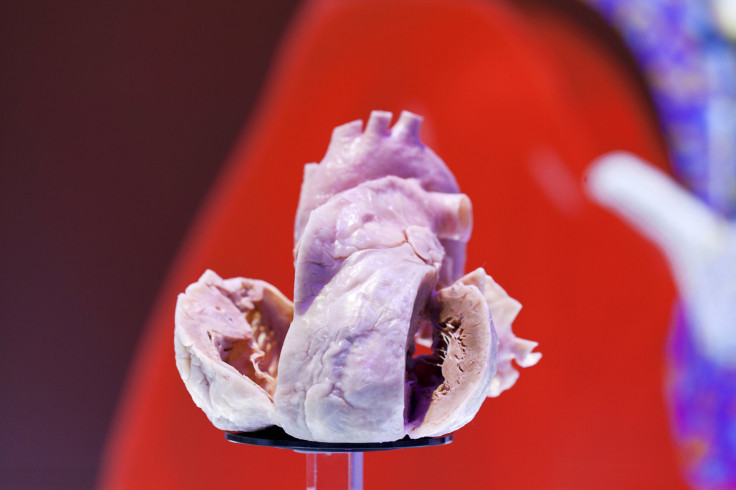 heart plastinated