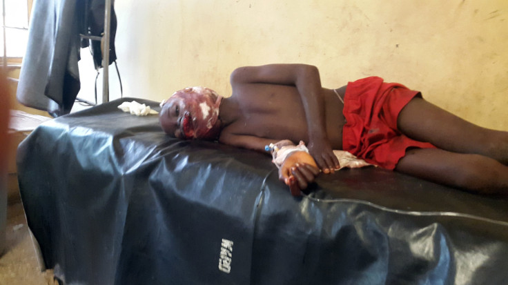 Bombing Victim, Damaturu, Nigeria, June 18, 2014