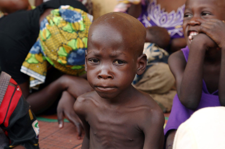 Malnourished Nigerian child