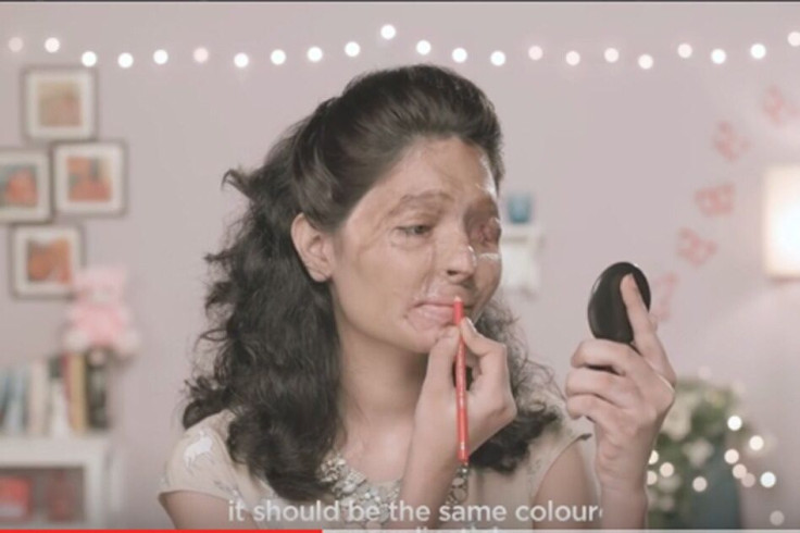 Reshma Acid Attack Survivor