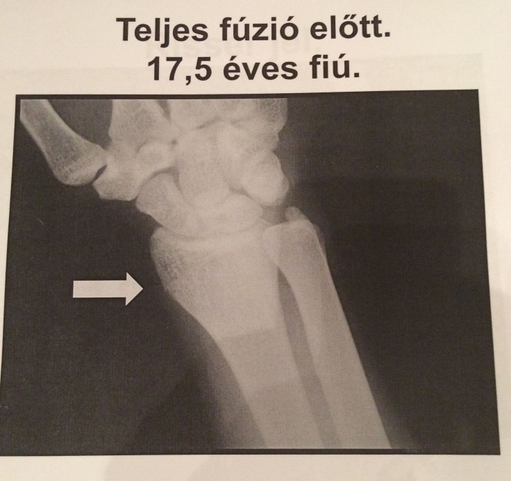 X-rays Hungary