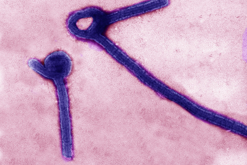 ebola virus