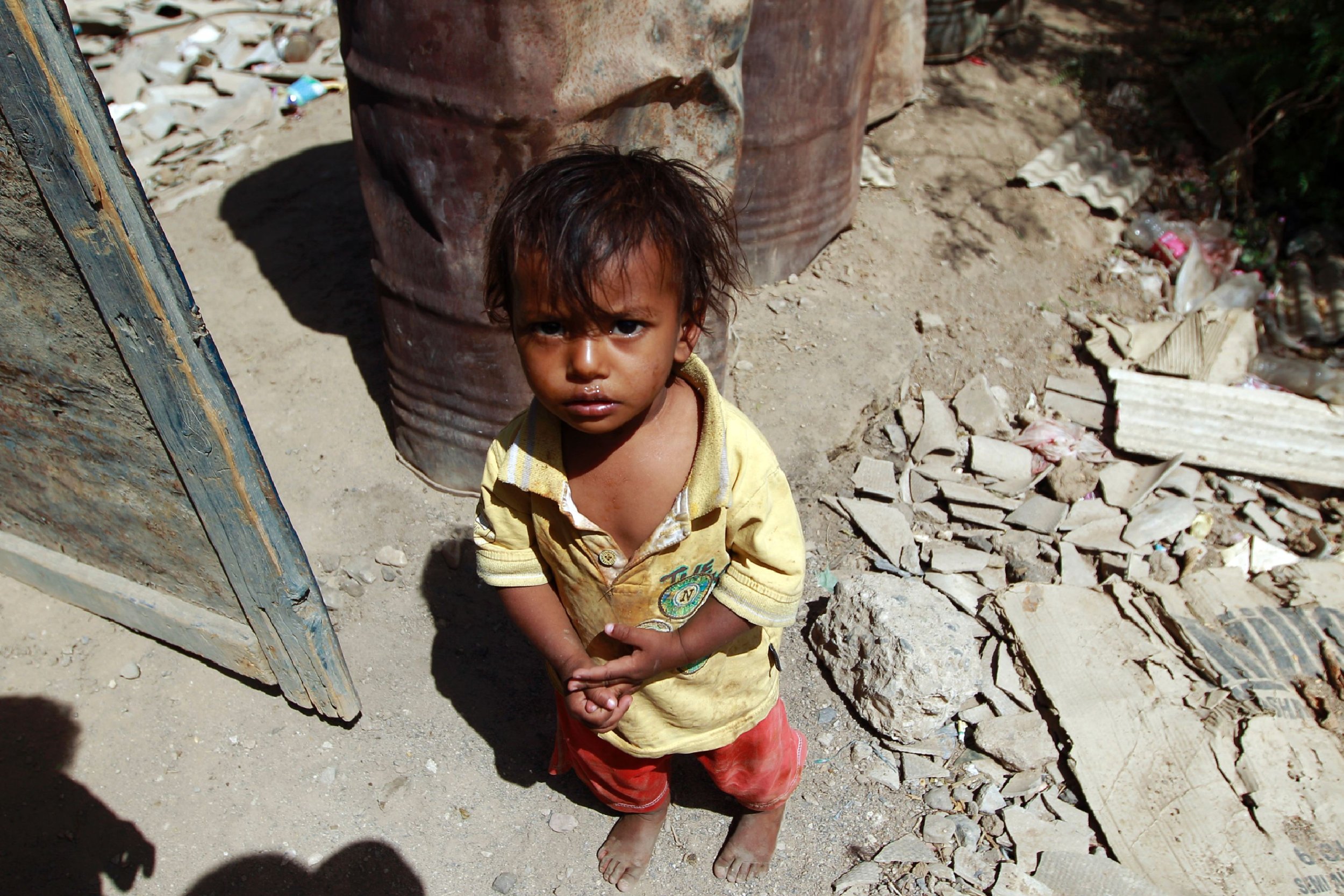 Голодные груднички. Голодающие люди в Йемене. Африканские дети Голодные. Африканские бездомные дети.