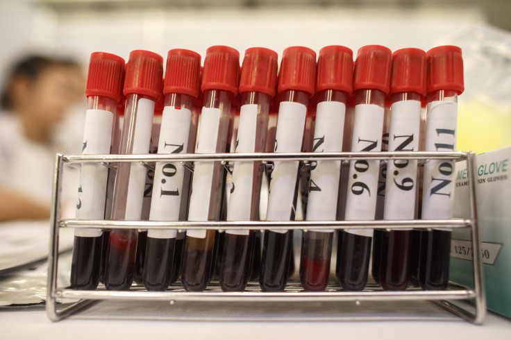 blood samples 