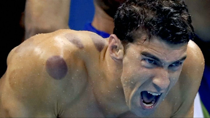 OLYMPICS-RIO-SWIMMING-PHELPS-CUPPING