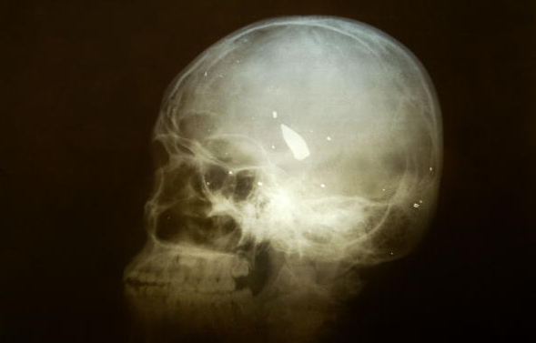 Brain